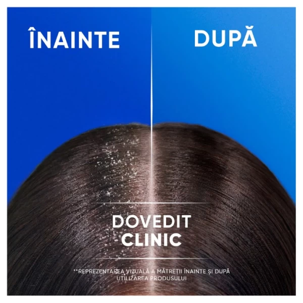 Head & Shoulders Sampon 800 ml cu pompa Clarify & Shine cu otet de mere - image 3