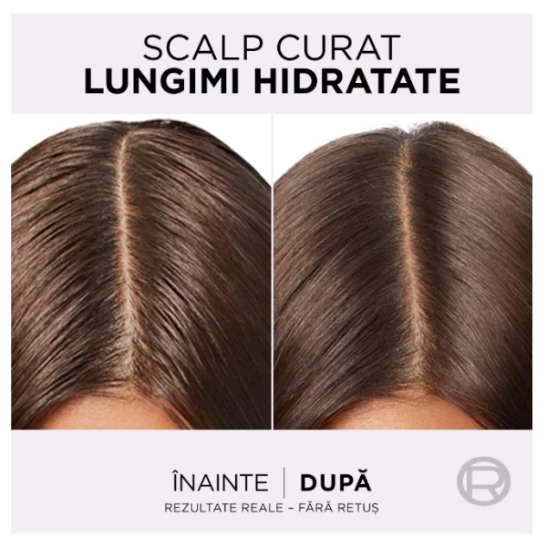 L'Oreal Paris Elseve Hyaluron Pure Очищающий шампунь для жирной кожи головы и корней, а также обезво - image 5