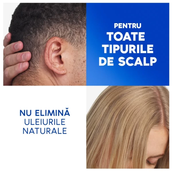 Head & Shoulders Шампунь Citrus Fresh 625 мл - image 6