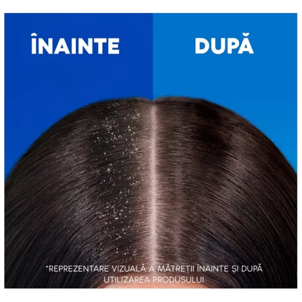 Head & Shoulders Sampon 625 ml 2in1 Classic Clean - image 4