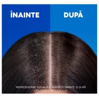 Head & Shoulders Шампунь Citrus Fresh 625 мл - thumbs image 4