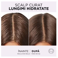 L'Oreal Paris Elseve Hyaluron Pure Очищающий шампунь для жирной кожи головы и корней, а также обезво - thumbs image 5