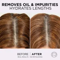 Elseve Sampon purificator 250ml Hyaluron Pure - thumbs image 4