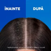 Head & Shoulders Sampon 800 ml cu pompa Menthol pentru orice tip de par - thumbs image 4